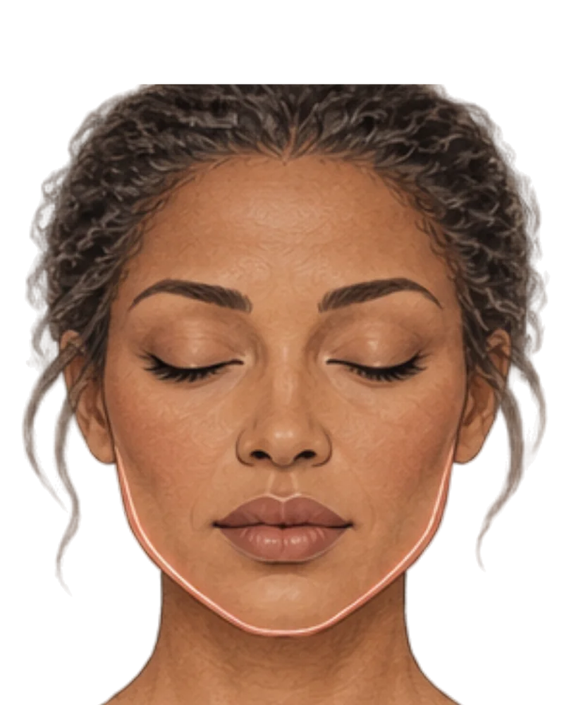 Illustration of a face with the jawline and chin outlined, showing the areas assessed for contour and proportion.